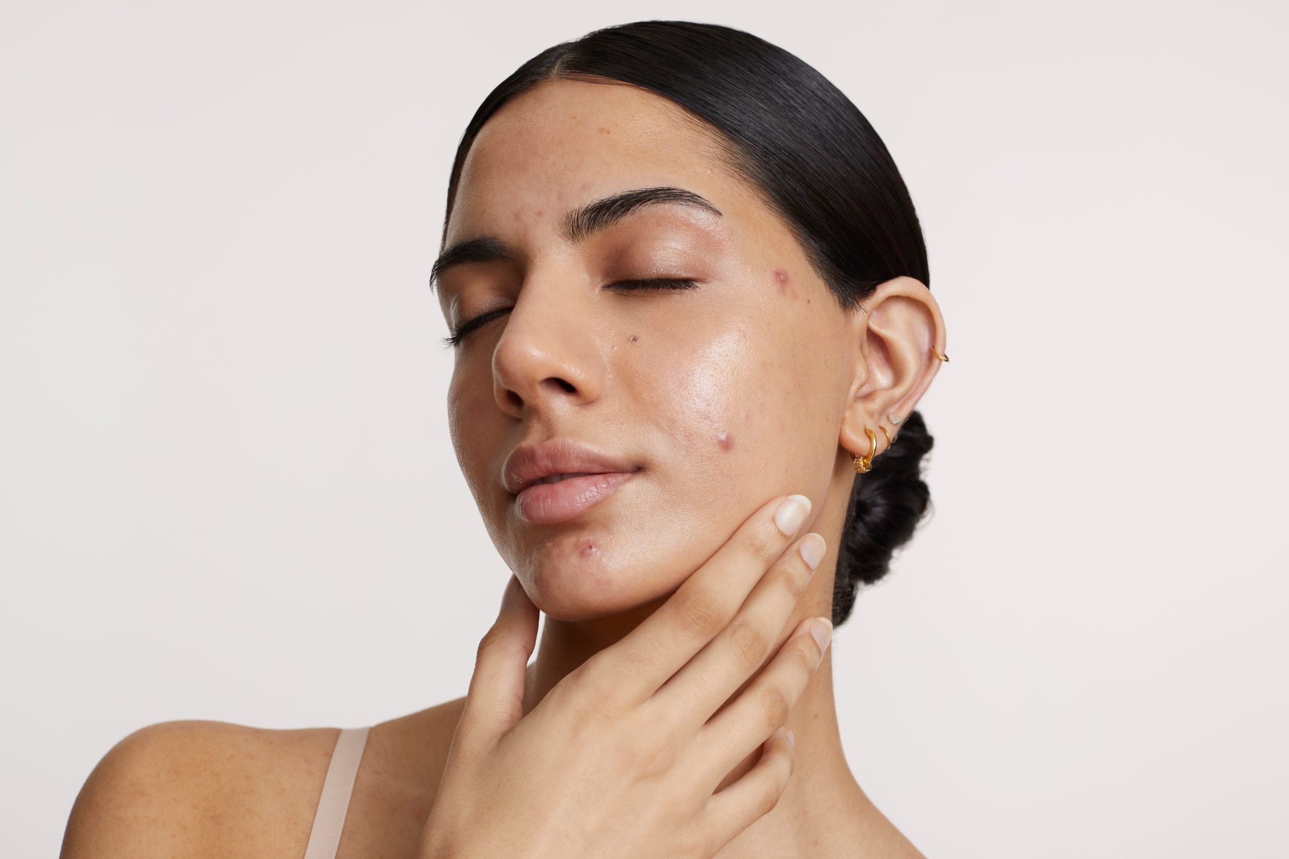 Femme appliquant un soin visage dans le cadre d’une routine anti-imperfections après l’été pour retrouver une peau nette et saine.